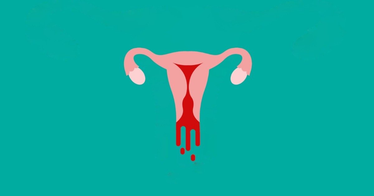 Nidação ou menstruação??, menstruação rosa 