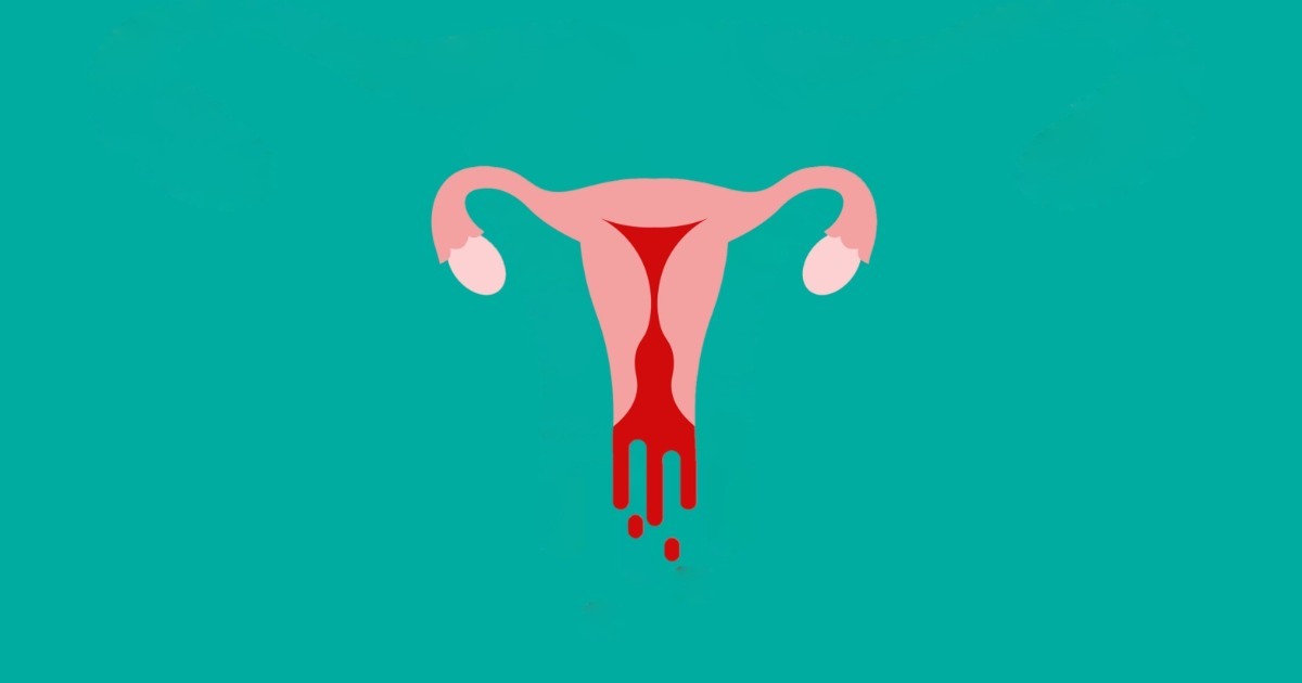 Nidação ou menstruação??, menstruação rosa 