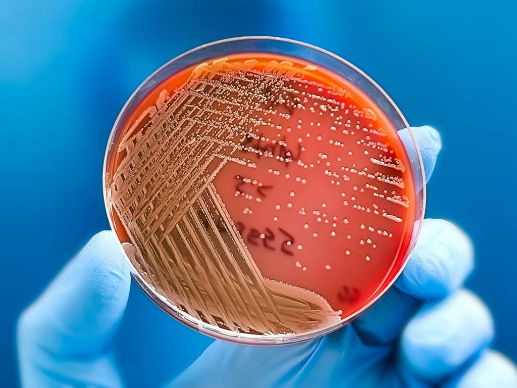 Mão enluvaga segura uma placa transparente de pesquisa científica, de fundo vermelho, repleto de pontinhos de cor amarelo que são bactérias.
